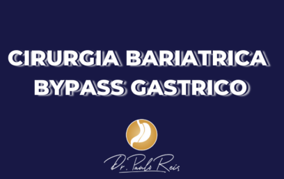 CIRURGIA BARIATRICA BYPASS GASTRICO